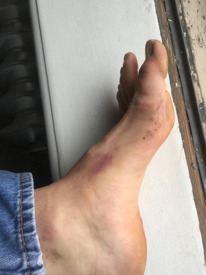 [Thumbnail for Sides-of-Foot.jpeg]